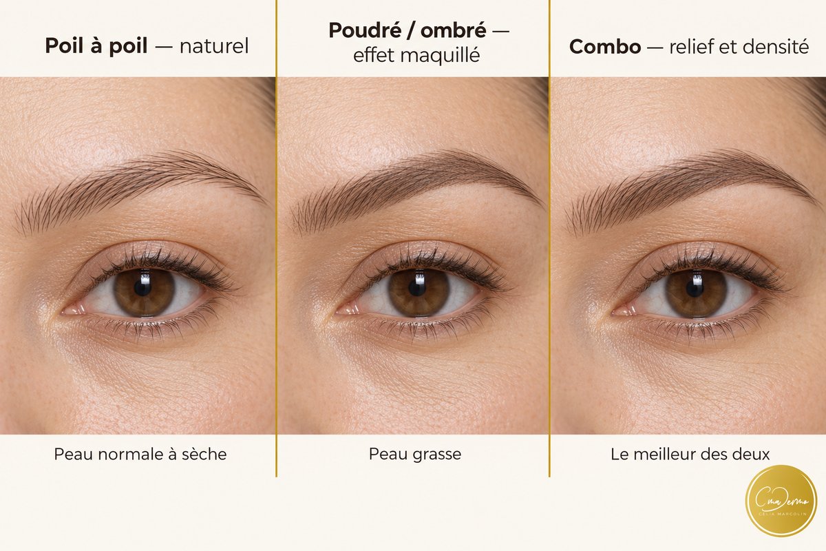 Sourcils — CmaDermo Académie Strasbourg