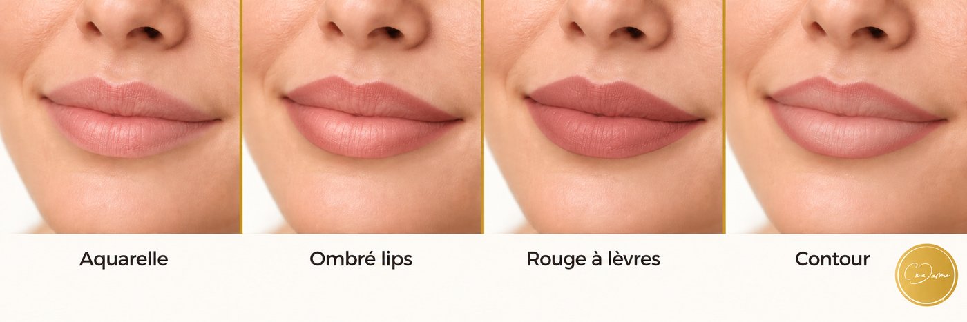 Bouche — CmaDermo Académie Strasbourg