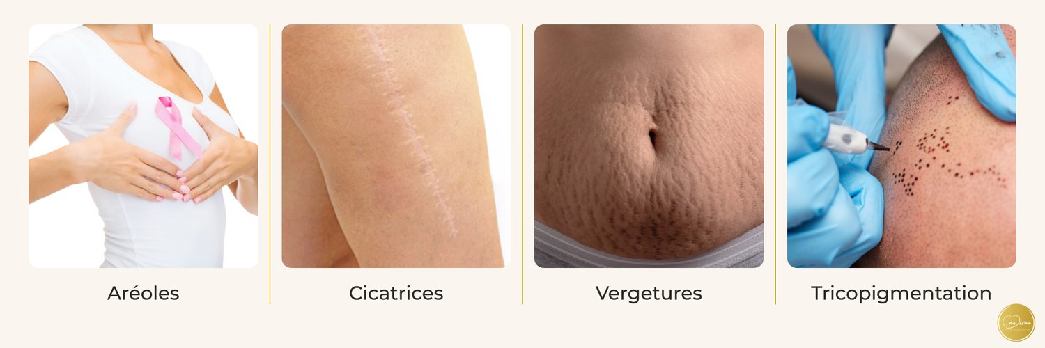 Dermopigmentation réparatrice — CmaDermo Académie Strasbourg